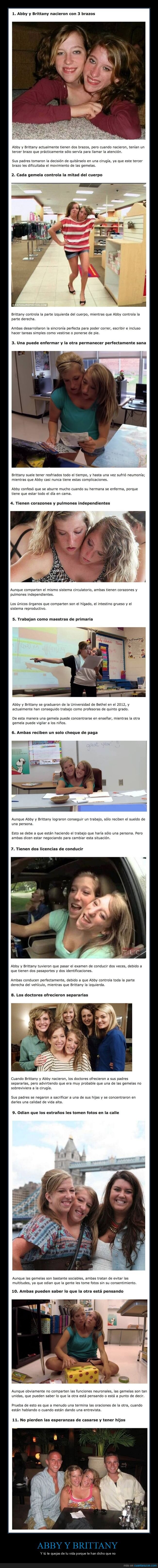 Abby,Brittany,gemelas,siamesas,unidas